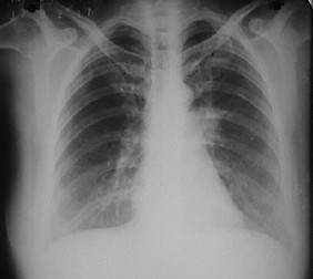 Click Imagen Ampliada