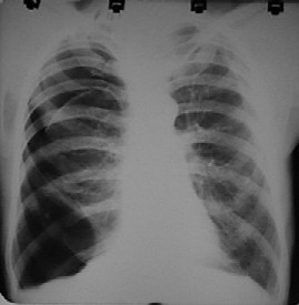 Click Imagen Ampliada