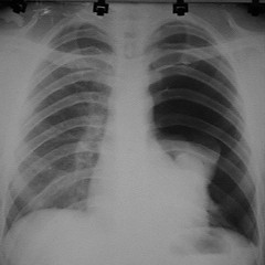 Click Imagen Ampliada